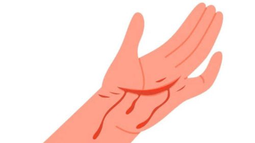 সিলেটের জালালপুরে মানুষের কাটা হাত