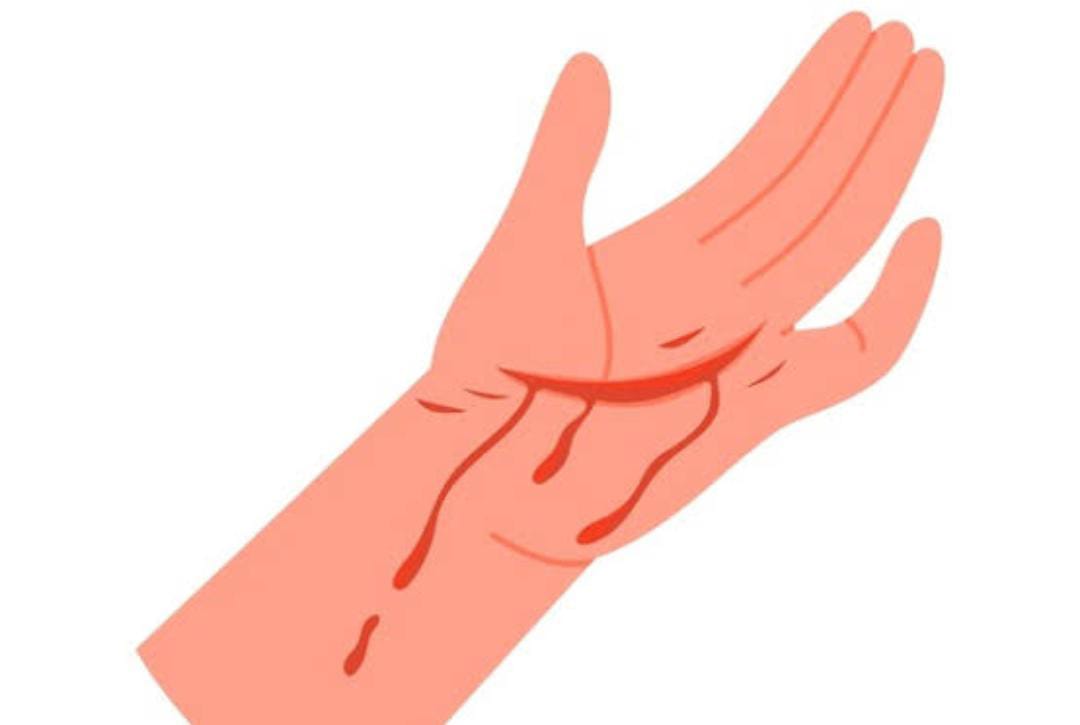 সিলেটের জালালপুরে মানুষের কাটা হাত