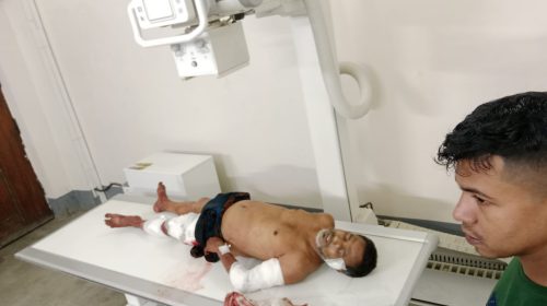 সিলেটে সন্ত্রাসী নাহিদের হামলায় মৃত্যু পথযাএী শওকত ওসমানীতে নগদ টাকা লুট