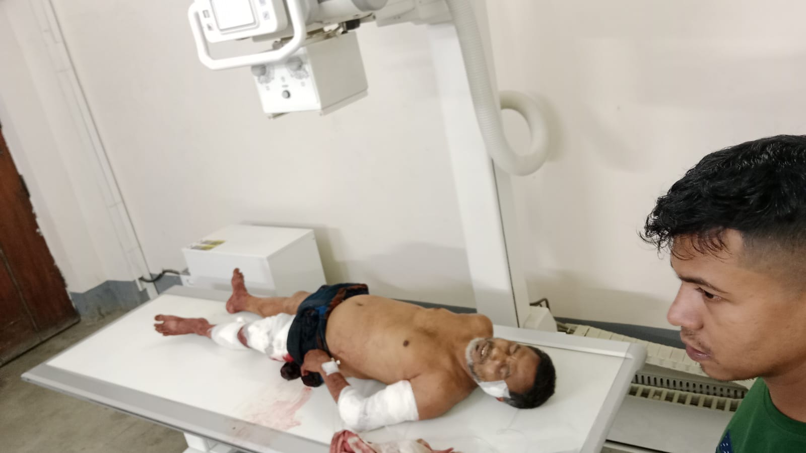 সিলেটে সন্ত্রাসী নাহিদের হামলায় মৃত্যু পথযাএী শওকত ওসমানীতে নগদ টাকা লুট