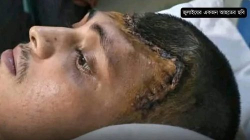 চিকিৎসকের-জবানবন্দি-১৬৭-জনের-বেশির-ভাগের-মাথার-খুলি-ছিল-না