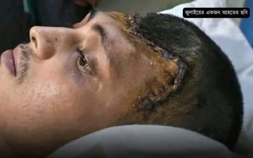 চিকিৎসকের-জবানবন্দি-১৬৭-জনের-বেশির-ভাগের-মাথার-খুলি-ছিল-না