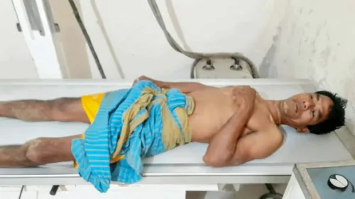 শেরপুরের ঝিনাইগাতীতে হাতির আক্রমণে আহত -১