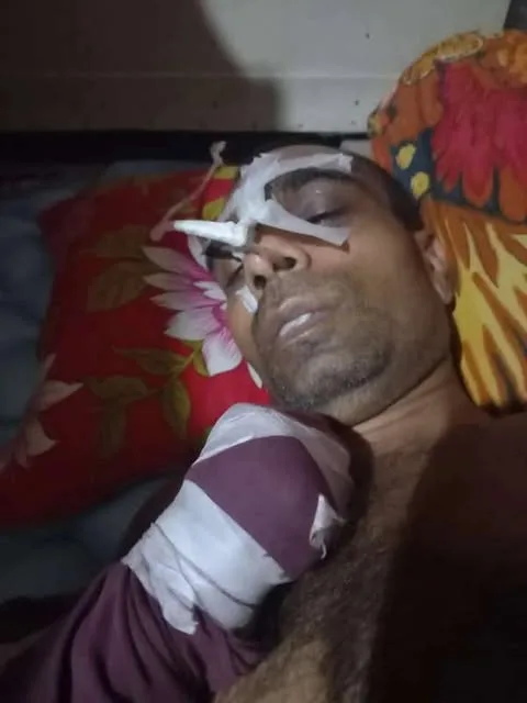 চাঁদা না দেওয়ায় পিটিয়ে জখম: চিকিৎসাধীন অবস্থায় উজ্জলের মৃত্যু, সন্ত্রাসী রাজু মেম্বার অধরা