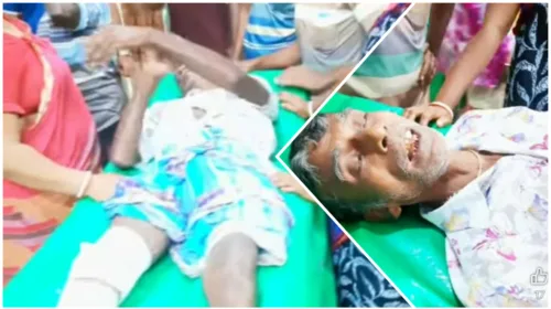 খুলনার দাকোপে কুমিরের ভয়াবহ হামলায় বৃদ্ধ আহত